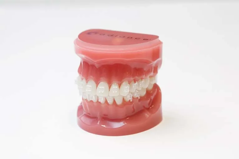 目立たない矯正歯科ーホワイトワイヤー矯正歯科